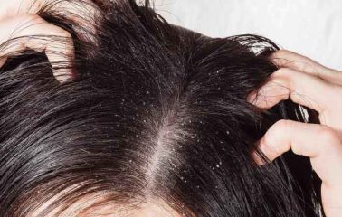 Tips To Grow Thick Hair Fast Long And Naturally In A Month Howto