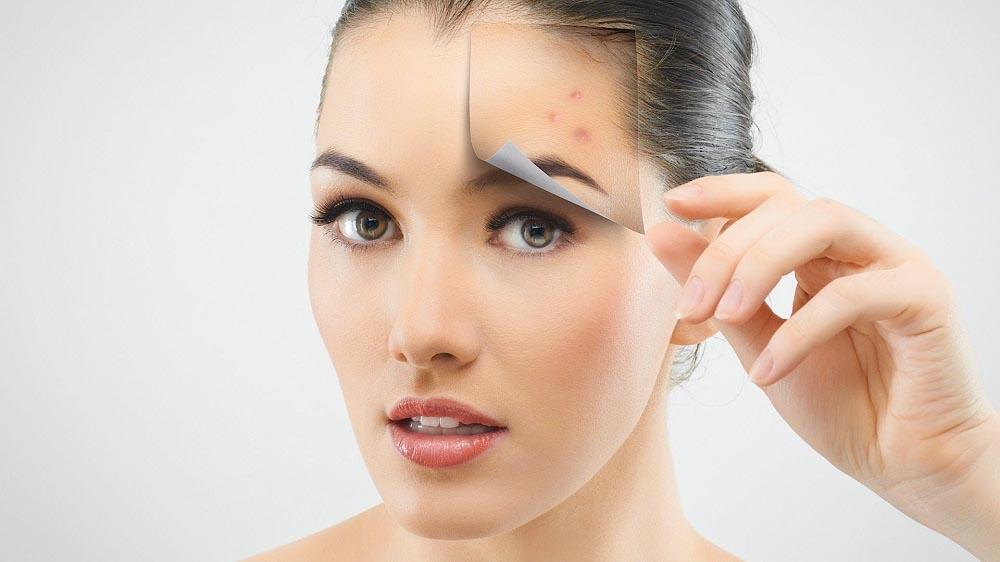 super-effective-rid-of-deep-acne-scars-once-and-for-all-howto