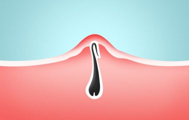 Tips To Grow Thick Hair Fast Long And Naturally In A Month Howto