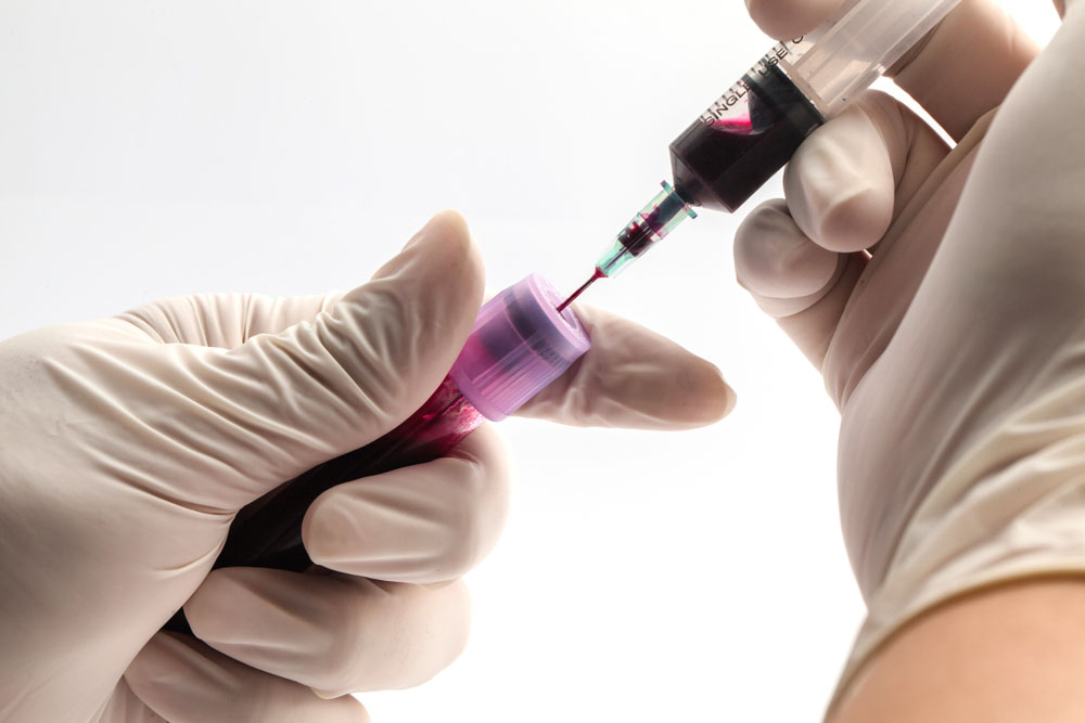 7-easy-steps-to-become-a-phlebotomist-be-successful-howto