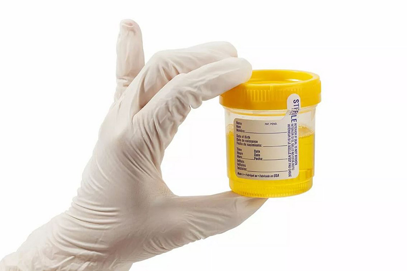 How to Keep Urine Warm in a Pill Bottle fot Test - Howto